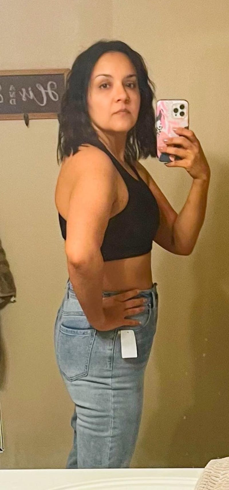 Patients 20-39 Years Old Before & After Gallery - Patient 55729295 - Image 2