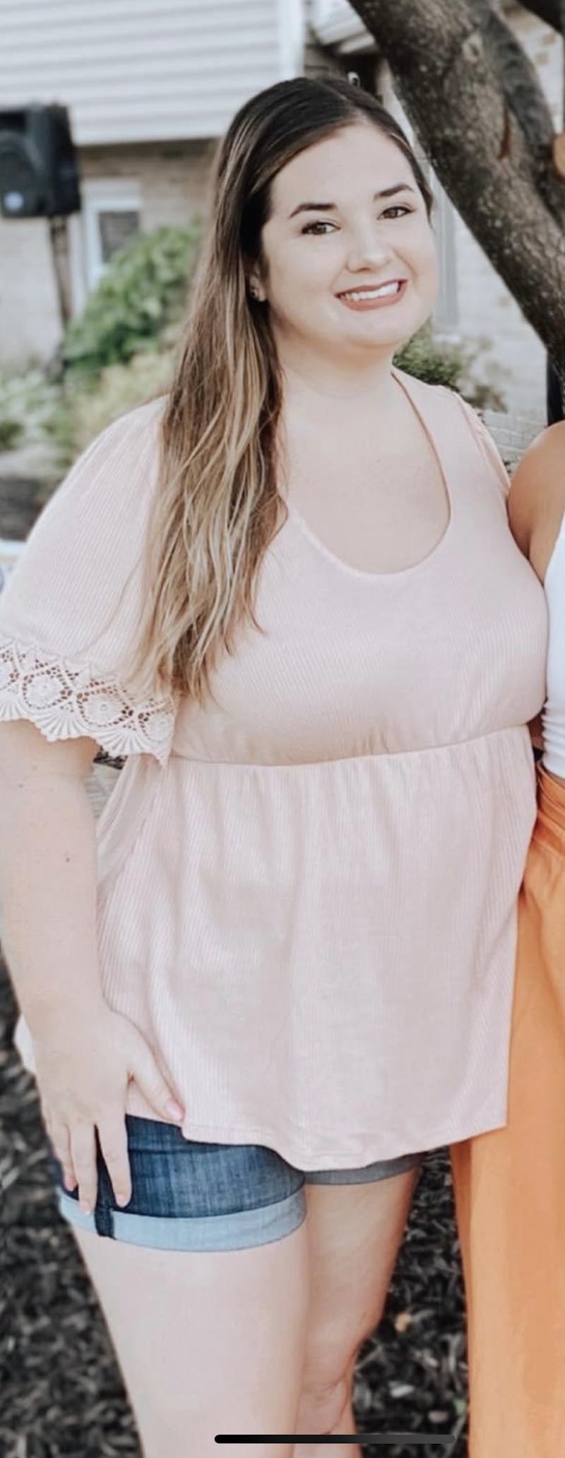 Patients 20-39 Years Old Before & After Gallery - Patient 55789917 - Image 1