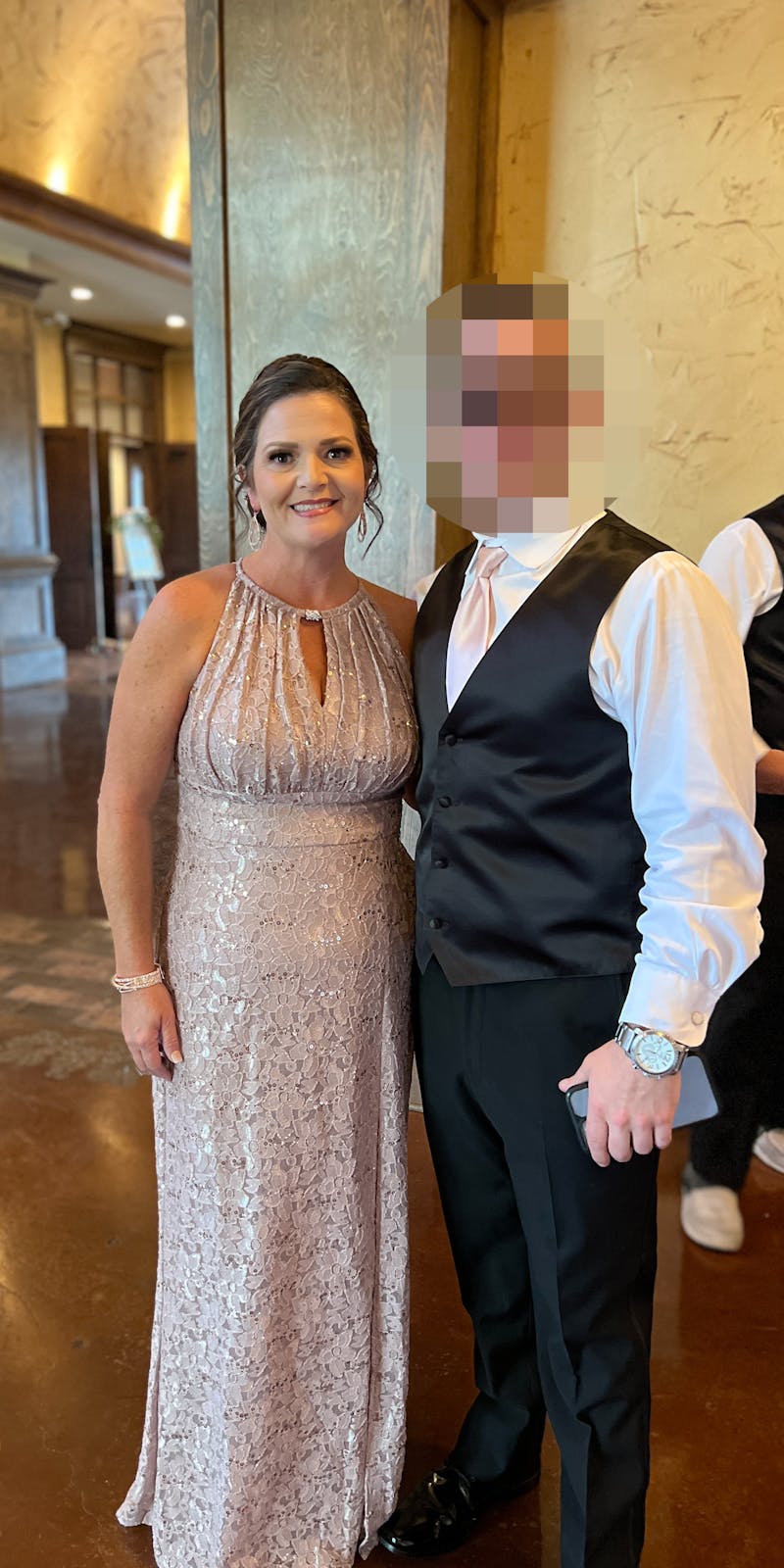 Patients 40-59 Years Old Before & After Gallery - Patient 55789919 - Image 2