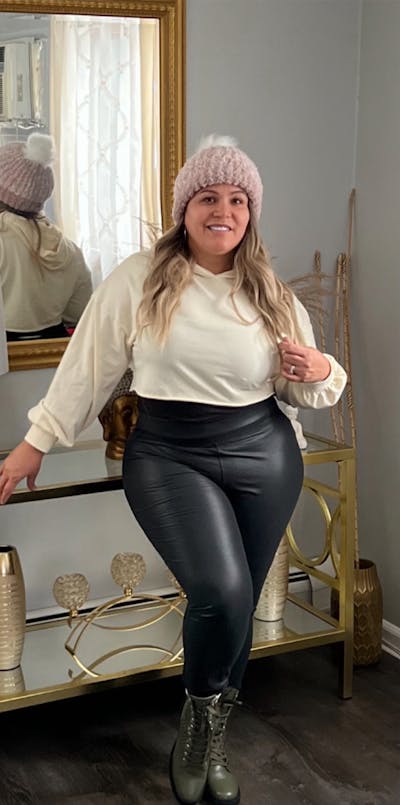 Patients 40-59 Years Old Before & After Gallery - Patient 55789927 - Image 1