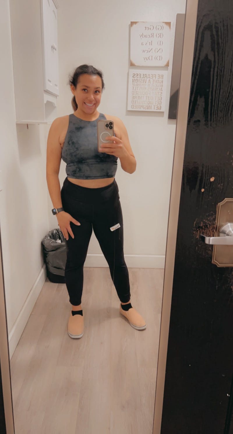 Patients 20-39 Years Old Before & After Gallery - Patient 55962165 - Image 2