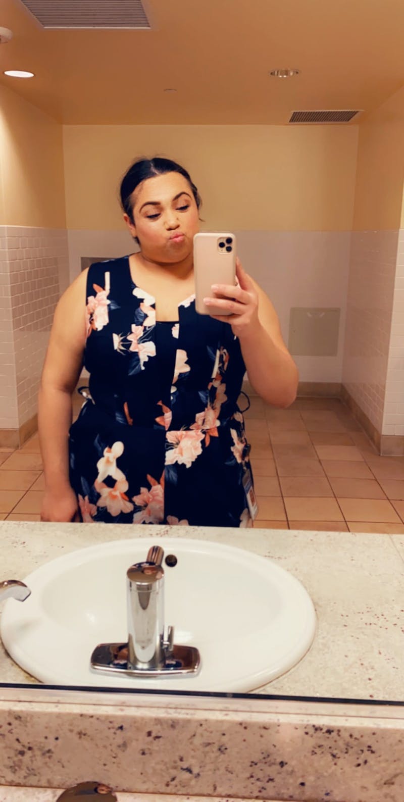 Patients 20-39 Years Old Before & After Gallery - Patient 55962165 - Image 1