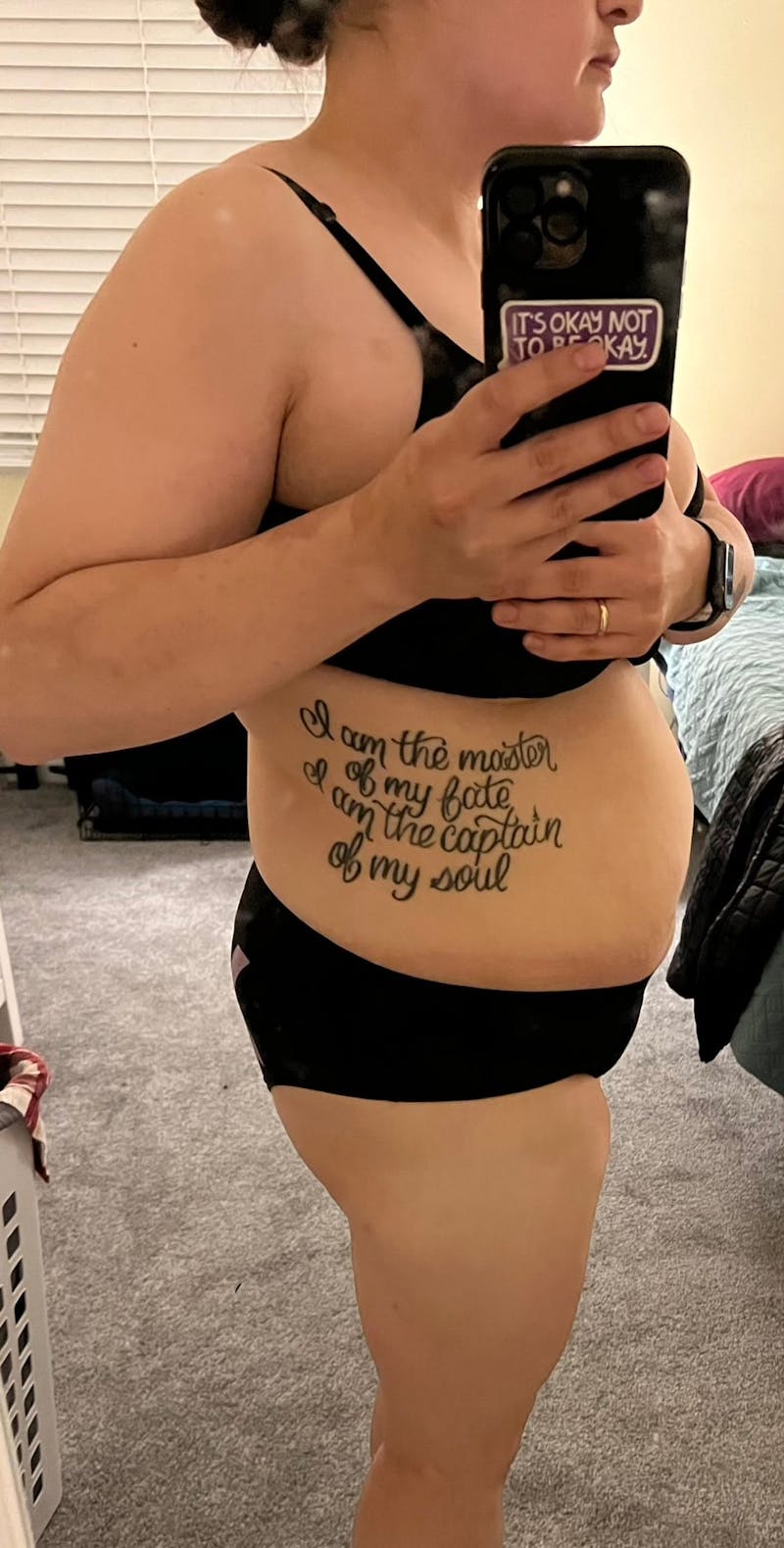 Patients 20-39 Years Old Before & After Gallery - Patient 55962166 - Image 2