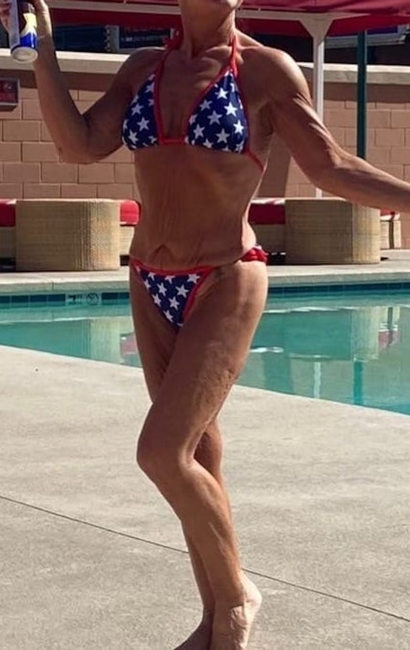 Patients 40-59 Years Old Before & After Gallery - Patient 55962172 - Image 2