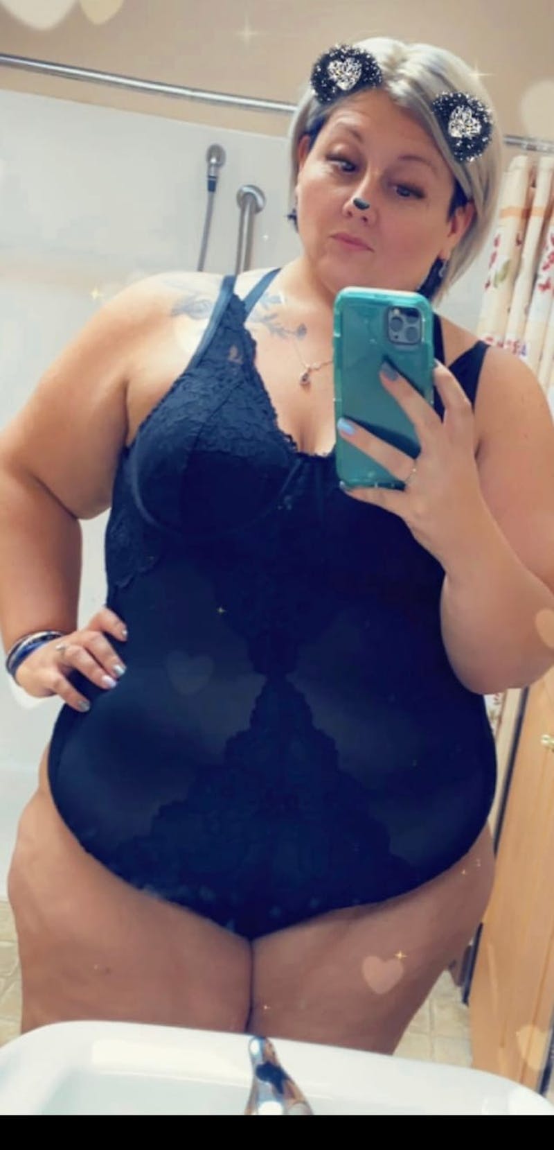 Patients 20-39 Years Old Before & After Gallery - Patient 56055572 - Image 1