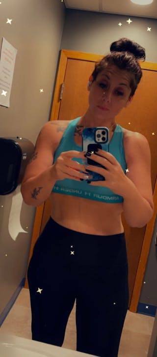 Patients 20-39 Years Old Before & After Gallery - Patient 56055572 - Image 2