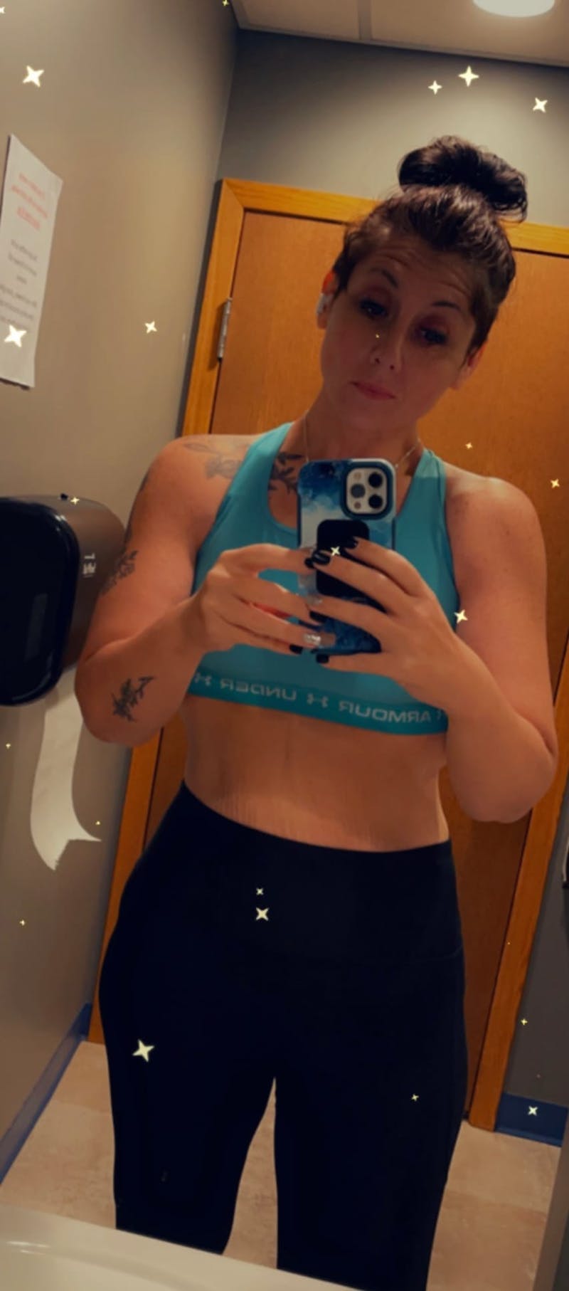 Patients 20-39 Years Old Before & After Gallery - Patient 56055572 - Image 2