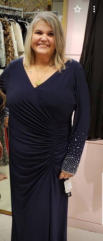 Patients 40-59 Years Old Before & After Gallery - Patient 57869783 - Image 1