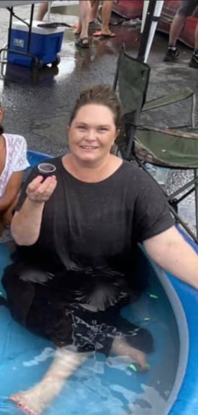 Patients 40-59 Years Old Before & After Gallery - Patient 57869859 - Image 1