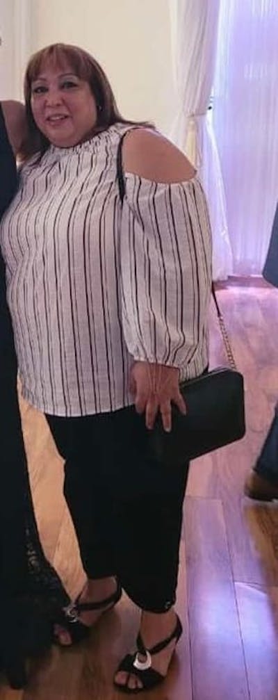 Patients 40-59 Years Old Before & After Gallery - Patient 63227711 - Image 1