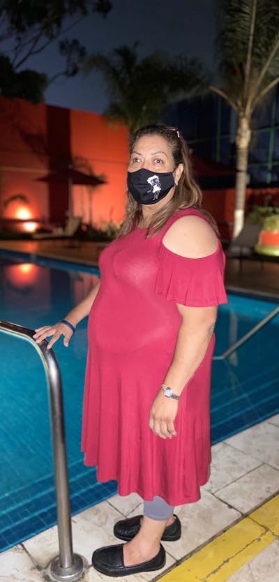 Patients 40-59 Years Old Before & After Gallery - Patient 63227820 - Image 1