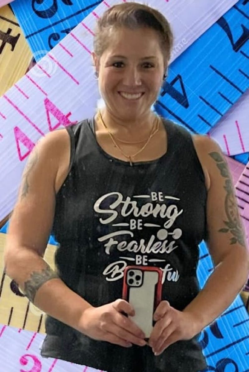 Patients 20-39 Years Old Before & After Gallery - Patient 63266811 - Image 2