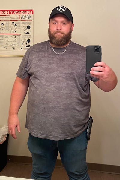 Patients 40-59 Years Old Before & After Gallery - Patient 63660204 - Image 1