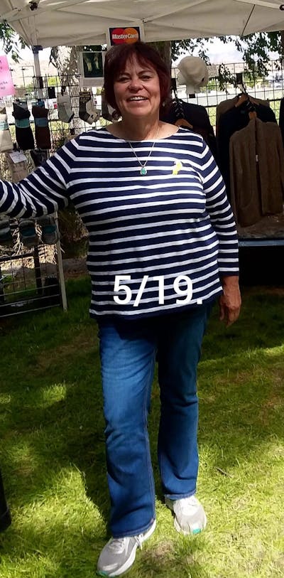 Patients 40-59 Years Old Before & After Gallery - Patient 63660206 - Image 1