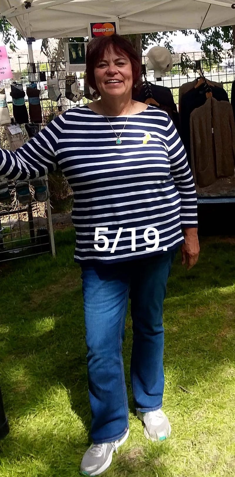 Patients 40-59 Years Old Before & After Gallery - Patient 63660206 - Image 1