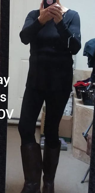 Patients 40-59 Years Old Before & After Gallery - Patient 63660206 - Image 2