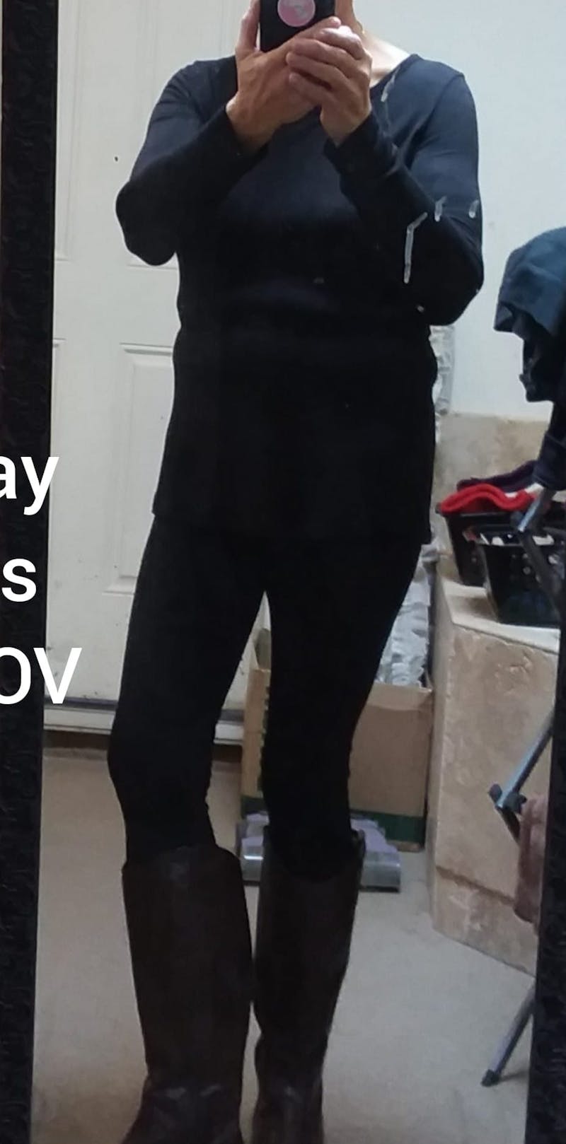 Patients 40-59 Years Old Before & After Gallery - Patient 63660206 - Image 2