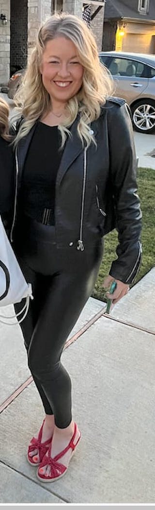 Patients 40-59 Years Old Before & After Gallery - Patient 63799142 - Image 2