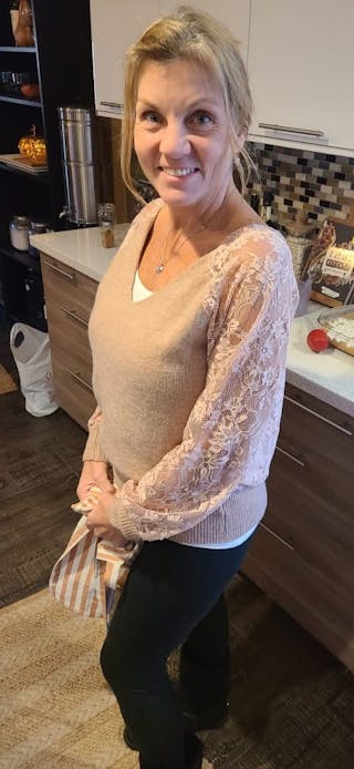 Patients 40-59 Years Old Before & After Gallery - Patient 63885399 - Image 2