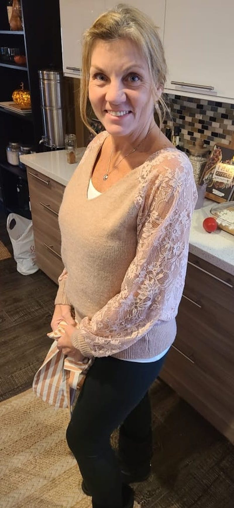 Patients 40-59 Years Old Before & After Gallery - Patient 63885399 - Image 2