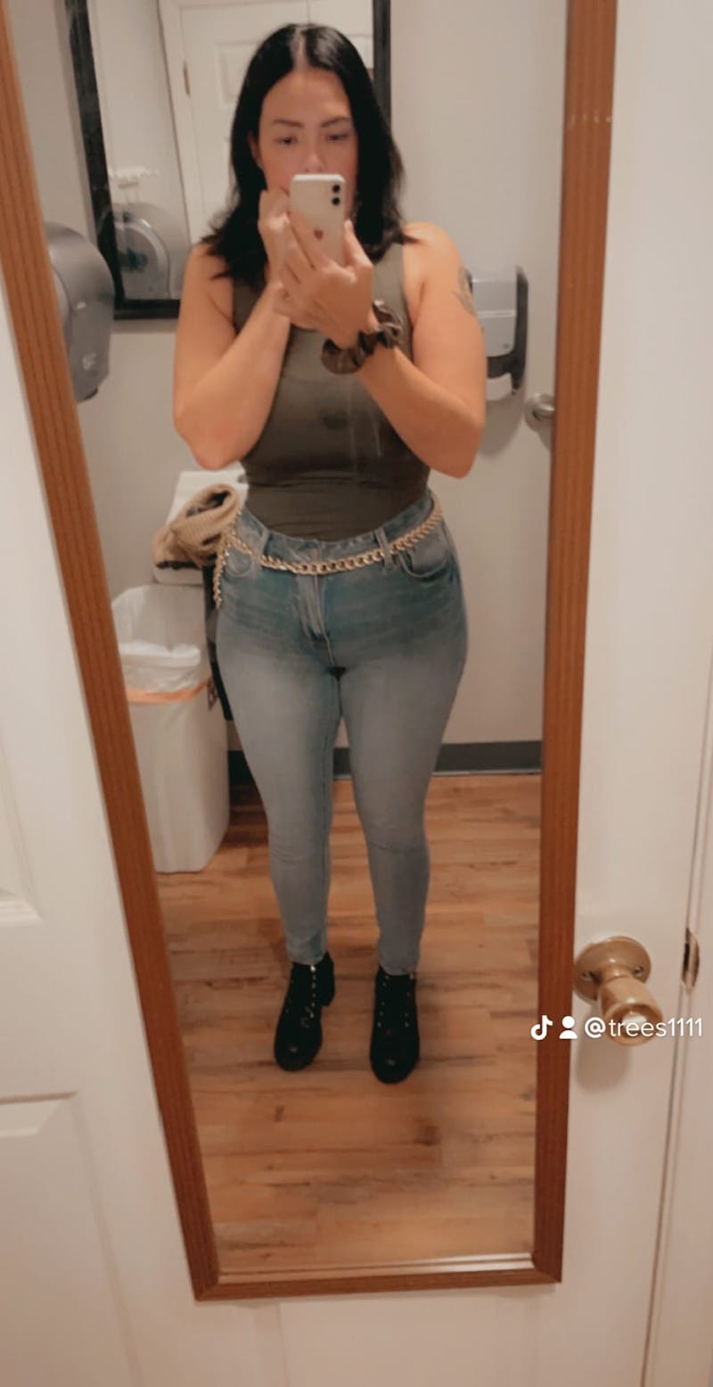 Patients 20-39 Years Old Before & After Gallery - Patient 63885405 - Image 2