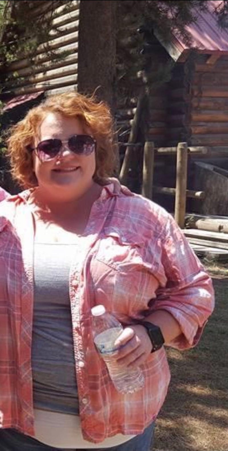 Patients 20-39 Years Old Before & After Gallery - Patient 63885407 - Image 1