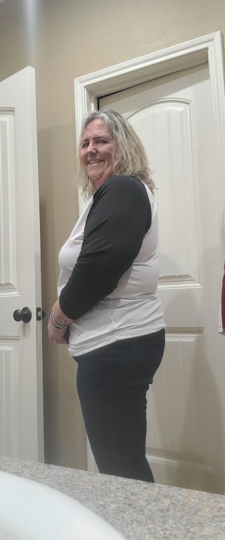 Patients 40-59 Years Old Before & After Gallery - Patient 64012048 - Image 2