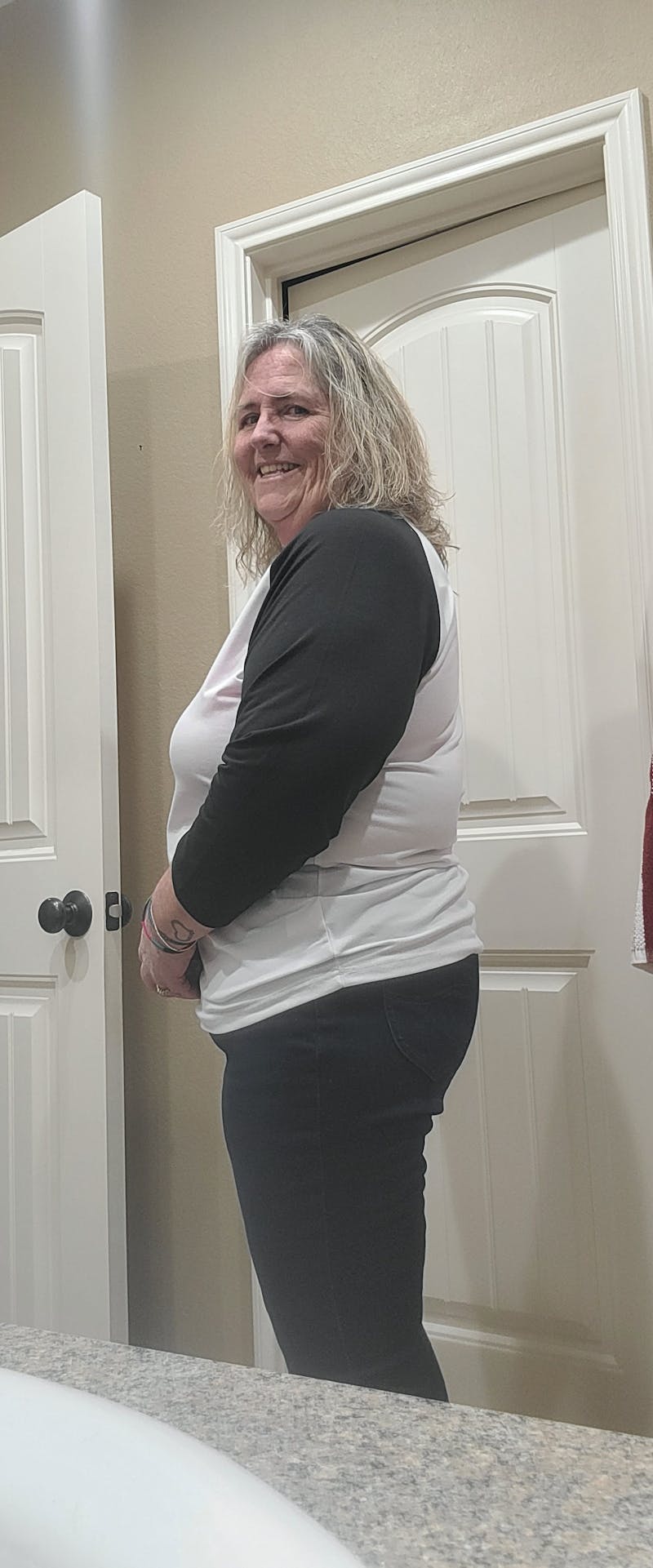 Patients 40-59 Years Old Before & After Gallery - Patient 64012048 - Image 2