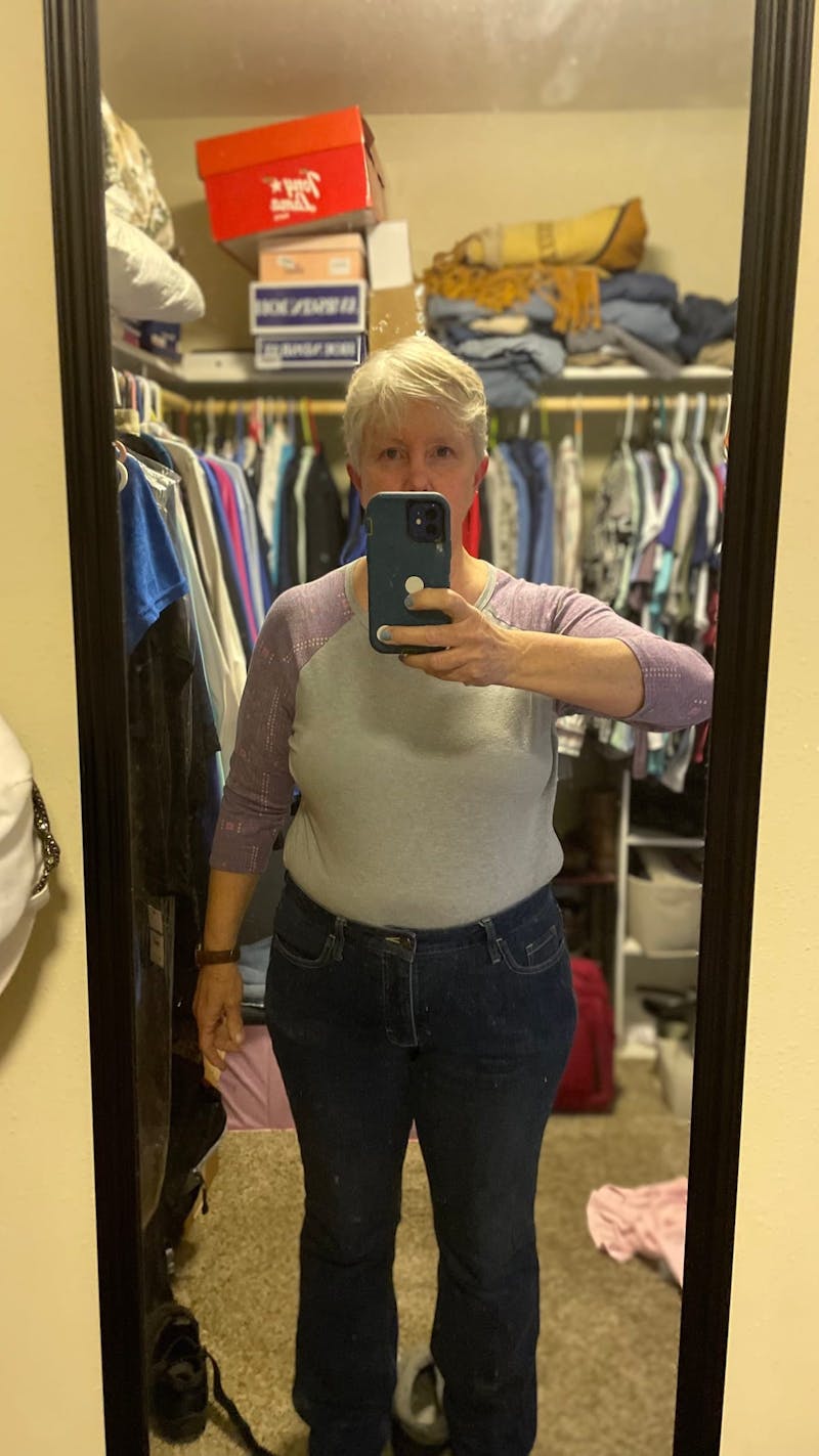 Patients 60-88 Years Old Before & After Gallery - Patient 64012053 - Image 1