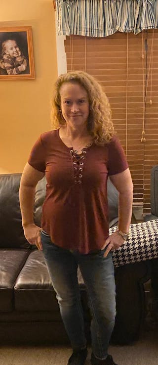 Patients 40-59 Years Old Before & After Gallery - Patient 64012062 - Image 2