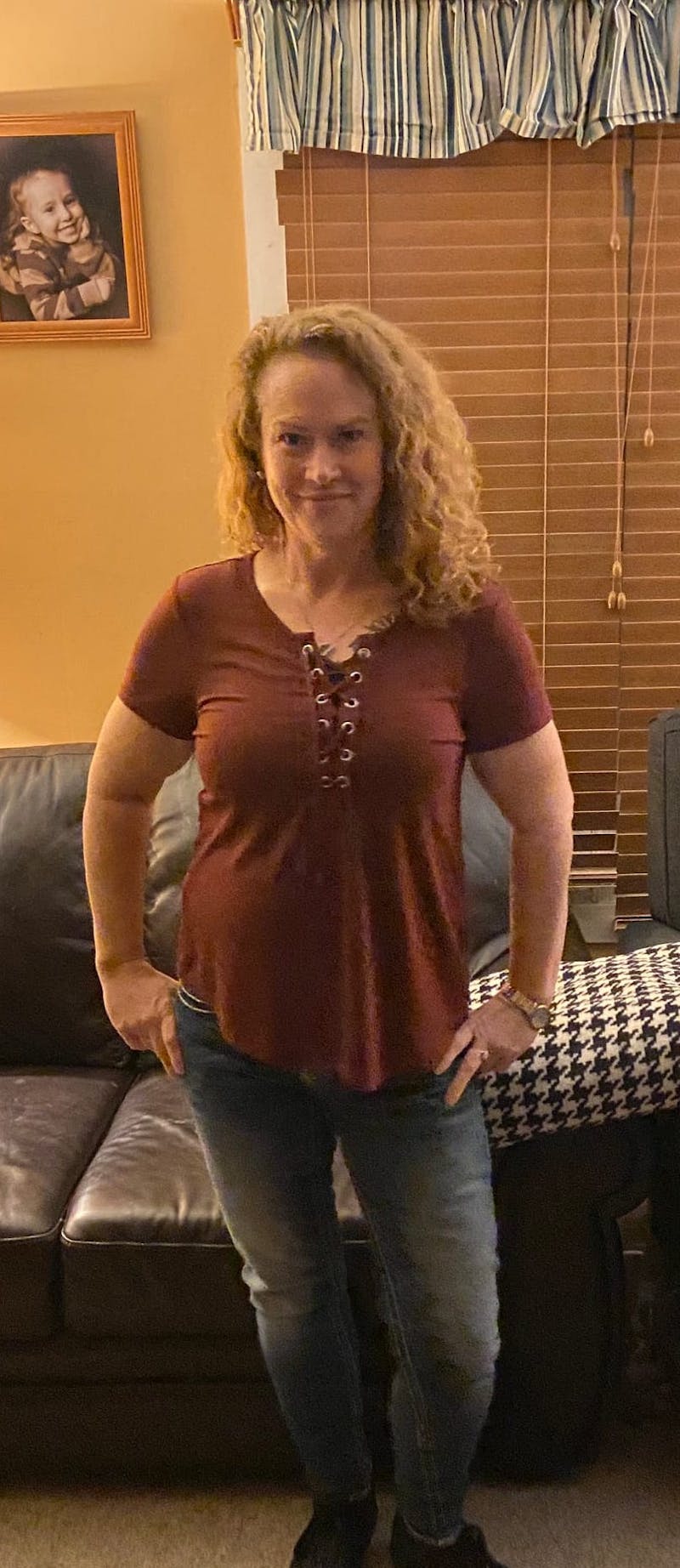 Patients 40-59 Years Old Before & After Gallery - Patient 64012062 - Image 2