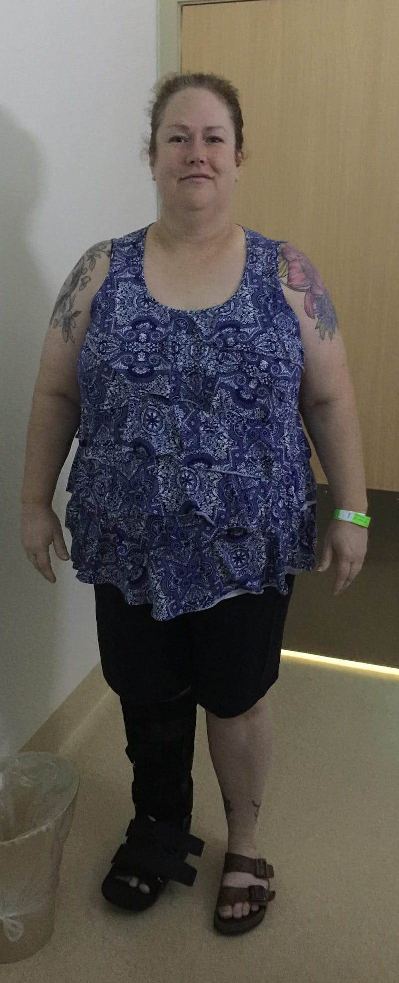 Patients 40-59 Years Old Before & After Gallery - Patient 64012062 - Image 1