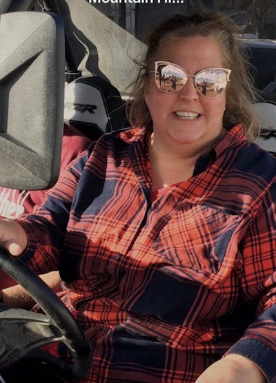 Patients 40-59 Years Old Before & After Gallery - Patient 73511727 - Image 1