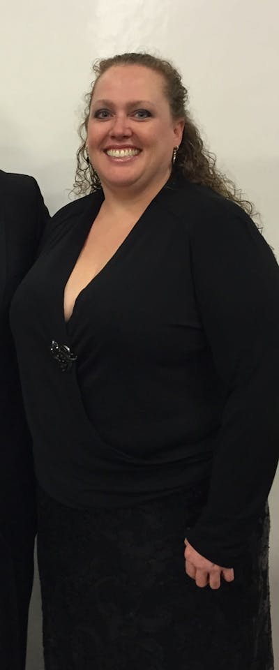 Patients 40-59 Years Old Before & After Gallery - Patient 73511728 - Image 1