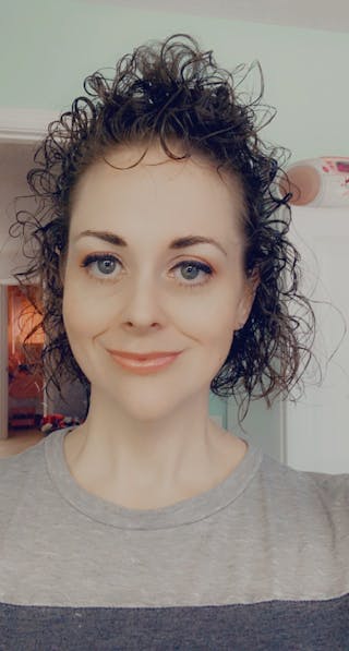 Patients 20-39 Years Old Before & After Gallery - Patient 73511729 - Image 2