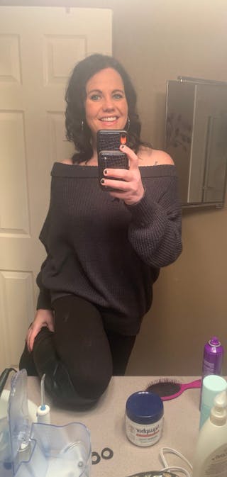 Patients 40-59 Years Old Before & After Gallery - Patient 94222162 - Image 2