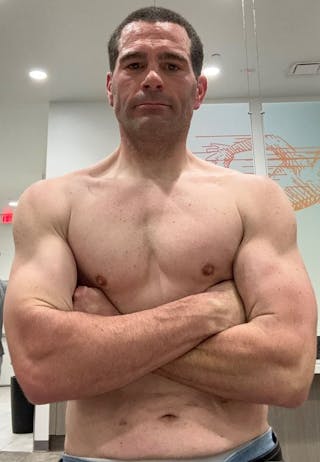 Patients 40-59 Years Old Before & After Gallery - Patient 94222163 - Image 2