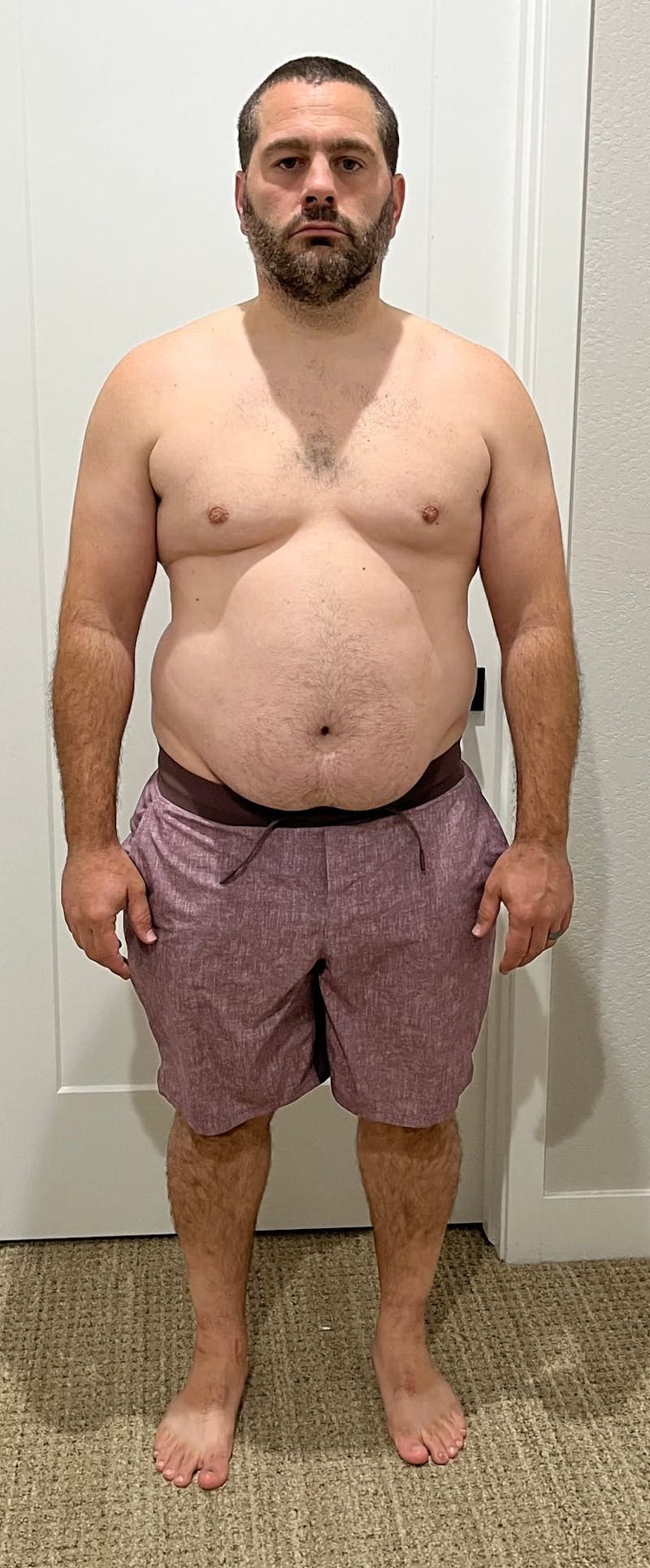 Patients 40-59 Years Old Before & After Gallery - Patient 94222163 - Image 1