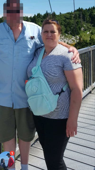 Patients 40-59 Years Old Before & After Gallery - Patient 108596557 - Image 1