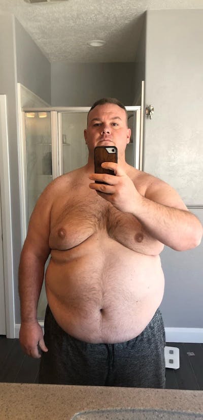 Patients 40-59 Years Old Before & After Gallery - Patient 108596563 - Image 1