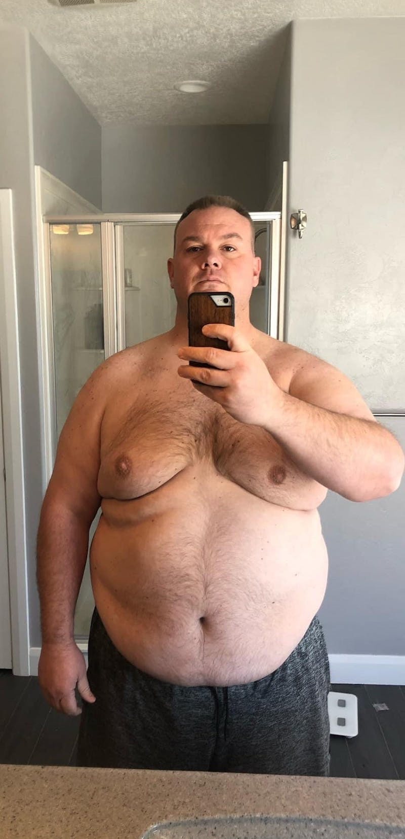 Patients 40-59 Years Old Before & After Gallery - Patient 108596563 - Image 1