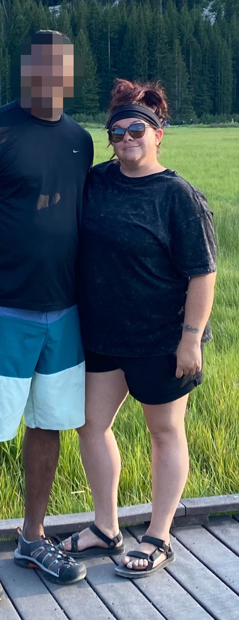 Patients 20-39 Years Old Before & After Gallery - Patient 108596569 - Image 1