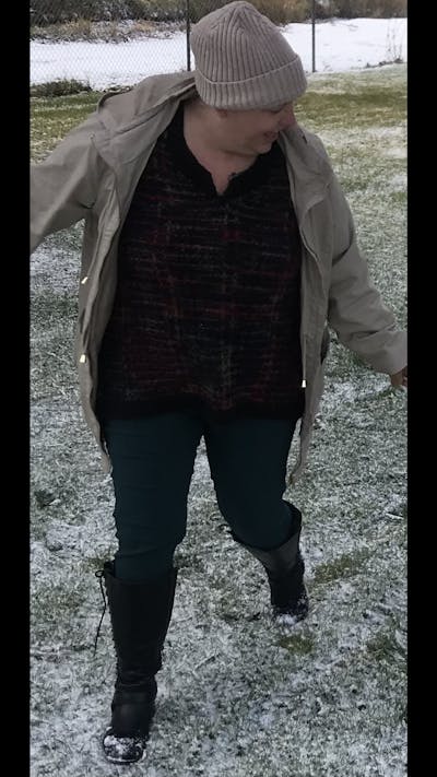 Patients 40-59 Years Old Before & After Gallery - Patient 114125253 - Image 1