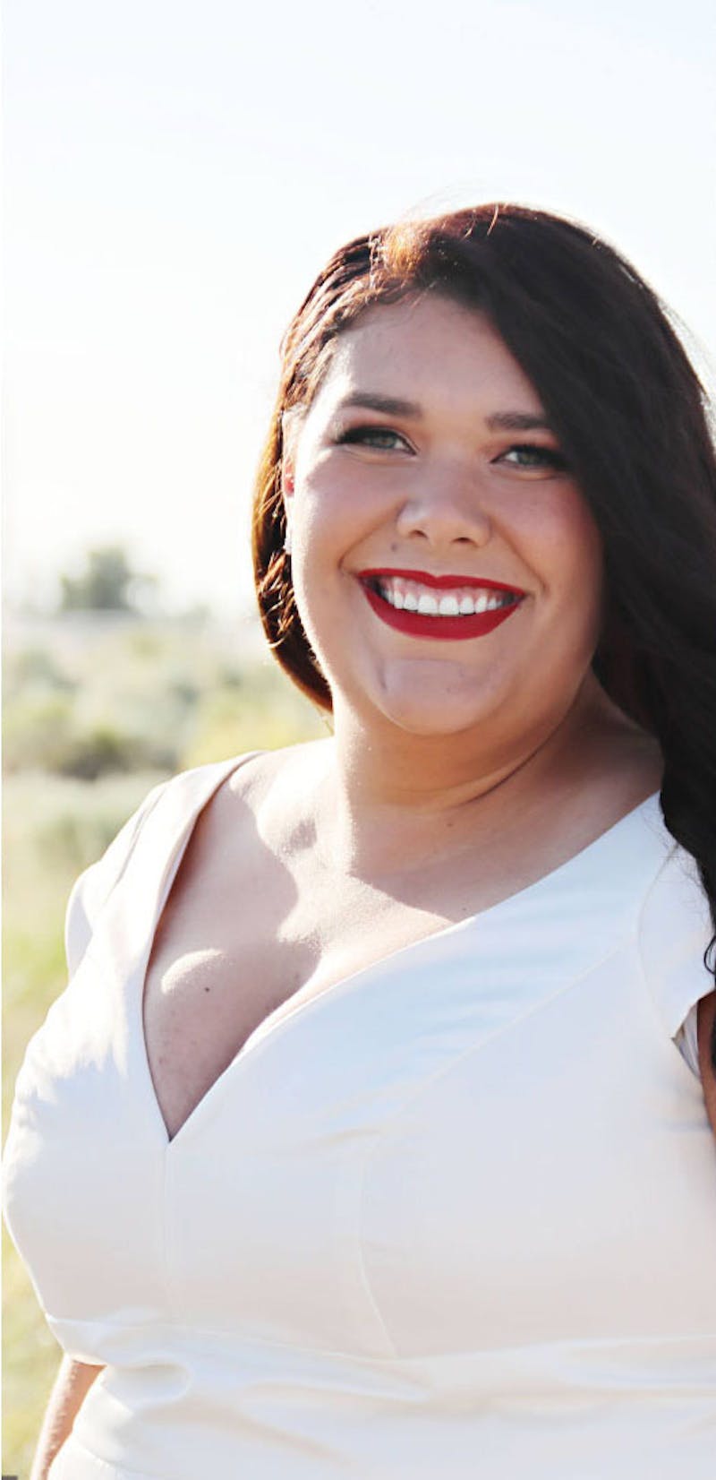 Patients 20-39 Years Old Before & After Gallery - Patient 114201839 - Image 1