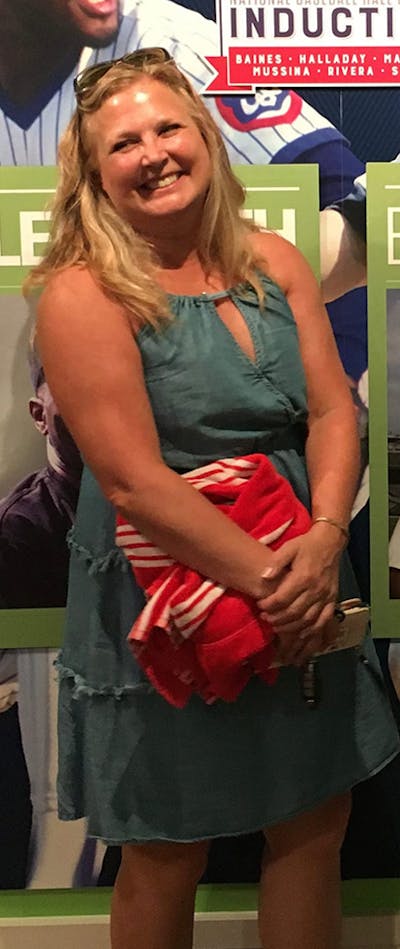 Patients 40-59 Years Old Before & After Gallery - Patient 117199073 - Image 1