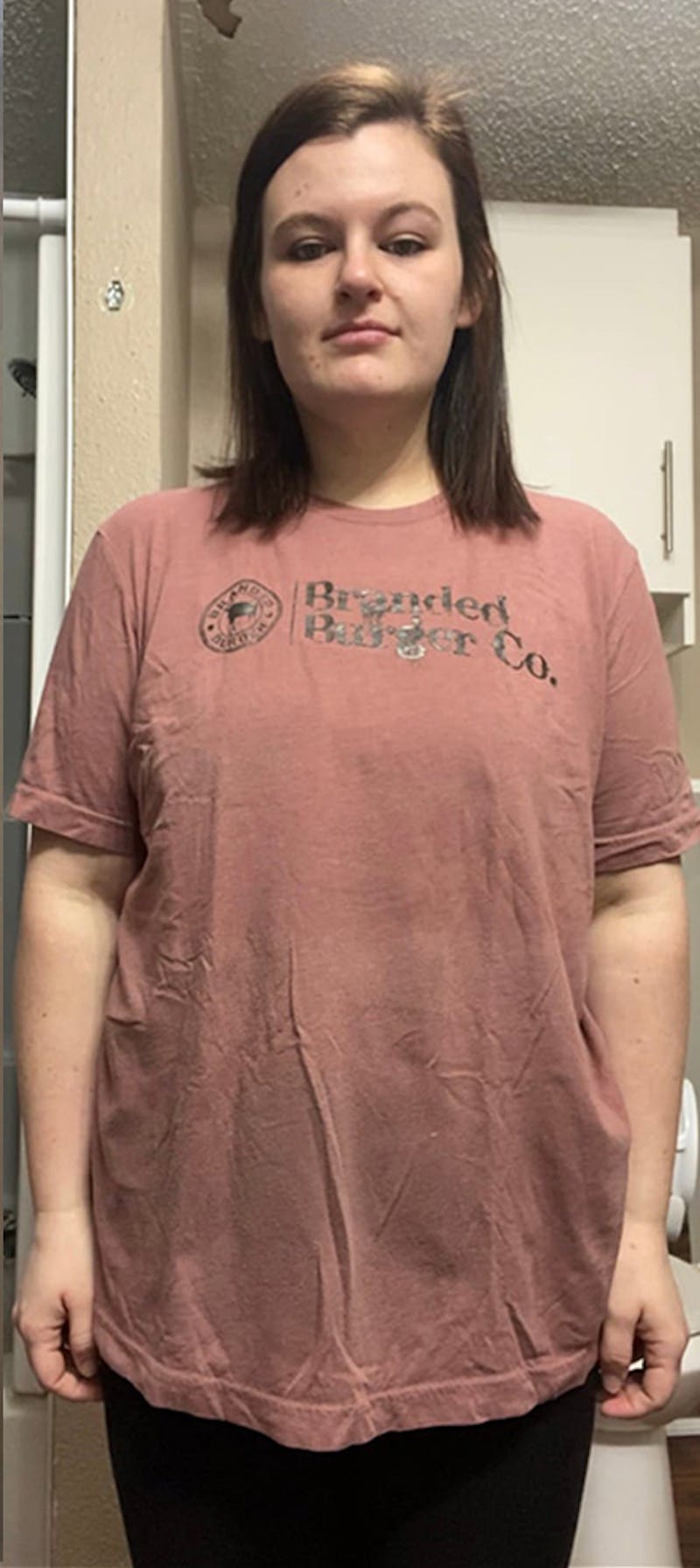 Patients 20-39 Years Old Before & After Gallery - Patient 114125232 - Image 2