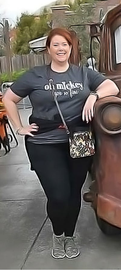 Patients 40-59 Years Old Before & After Gallery - Patient 122434611 - Image 1