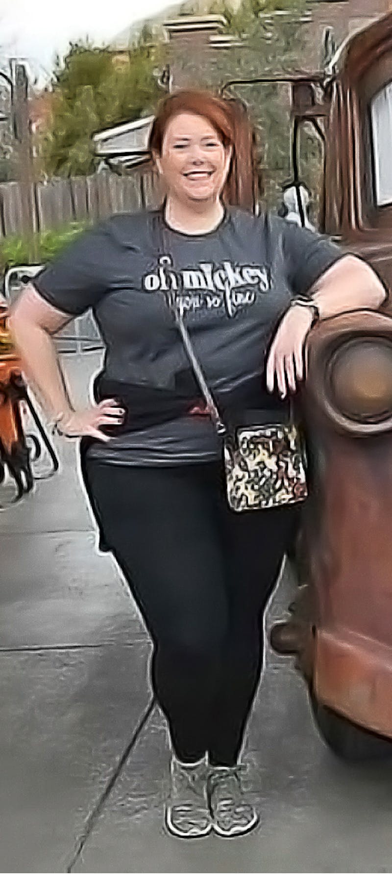 Patients 40-59 Years Old Before & After Gallery - Patient 122434611 - Image 1