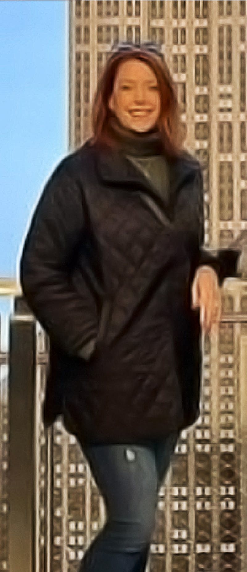 Patients 40-59 Years Old Before & After Gallery - Patient 122434611 - Image 2