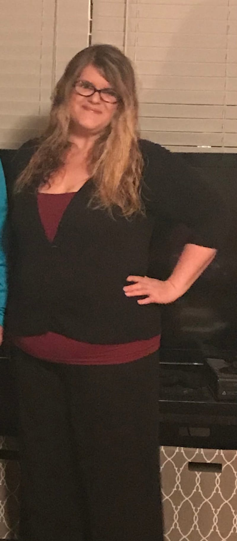 Patients 40-59 Years Old Before & After Gallery - Patient 122434613 - Image 1